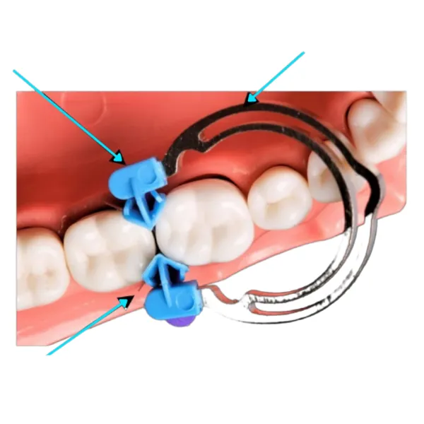 Twin_Force_Matrix_Kit_Without_Handle_Dental_Restorative