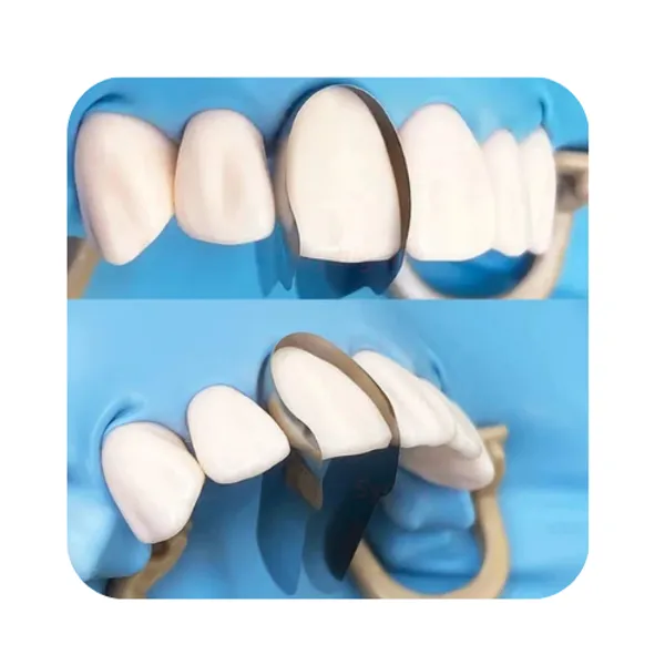 Stainless_Steel_Anterior_Pro-Veneer_Dental_Matrix