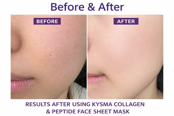 Collagen_Peptide_Face_Sheet_Mask