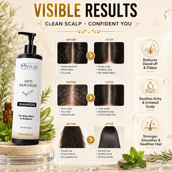 Anti_Dandruff_Shampoo_for_Flake-Free_Scalp_&_Healthy_Hair_|_Scalp_Purifying,_Oil_Control_&_Freshness_|_200ml