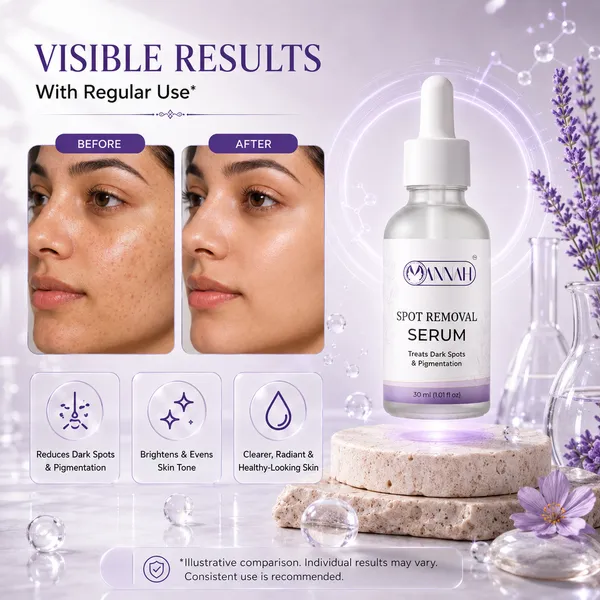 Spot_Removal_Face_Serum_for_Dark_Spots,_Brighter_Skin_&_Even_Tone_|_Daily_Brightening_&_Hydrating_Serum_|_30ml