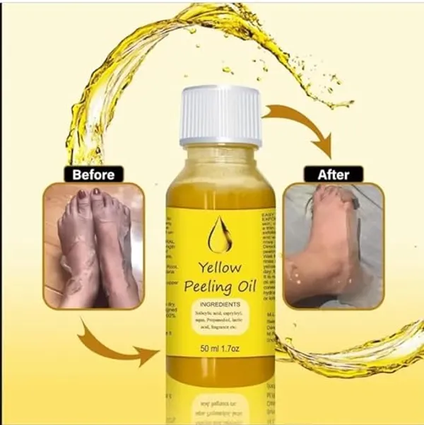 Yellow_Peeling_Oil_50_Ml_Pack_Of_2