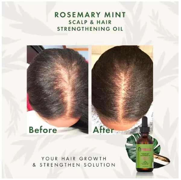 Mielle_Rosemary_Mint_Scalp_And_Hair_Strengthening_Oil