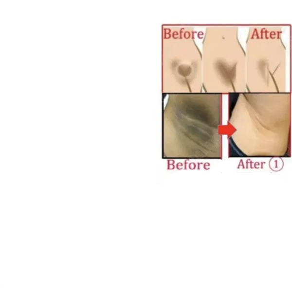 Fezora_Underarm_Cream_Skin_Whitening_50g