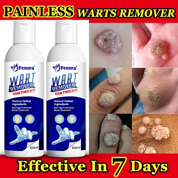 Jezora_Wart_Remover_Ointment