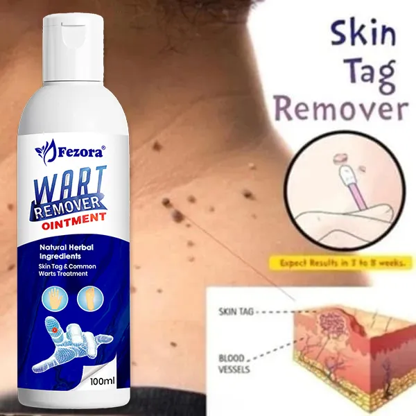 Jezora_Wart_Remover_Ointment