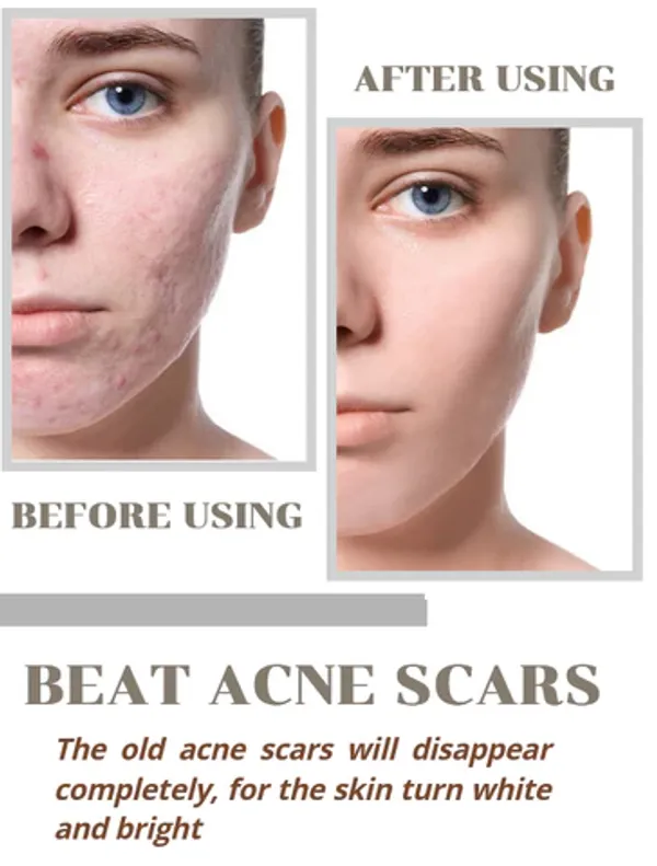 Niacid_Face_Serum