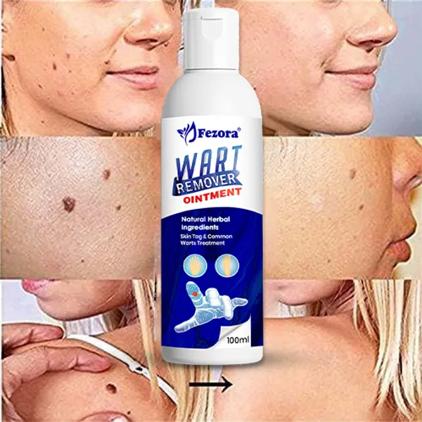 Jezora_Wart_Remover_Ointment