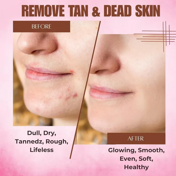 Fezora_Tanning_Dead_Skin_Remover_Face_And_Body