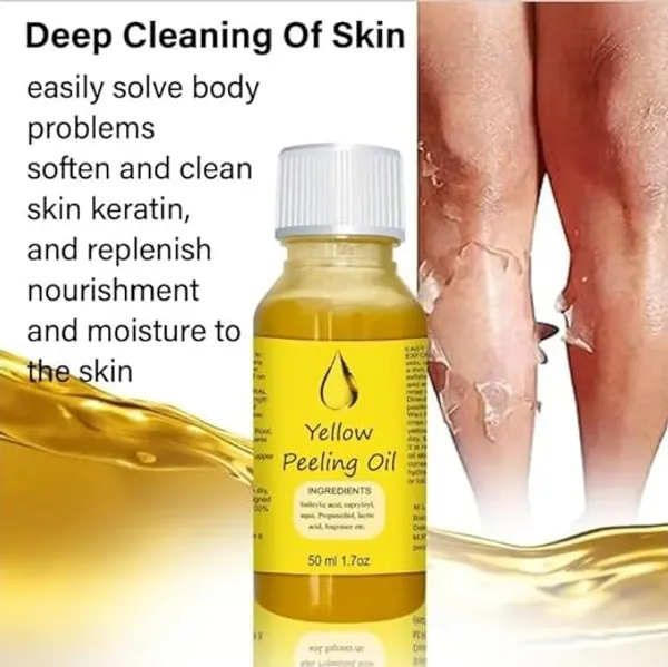 Yellow_Peeling_Oil_50_Ml_Pack_Of_2