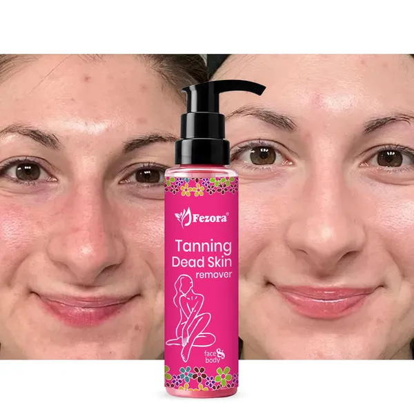 Fezora_Tanning_Dead_Skin_Remover_Face_And_Body