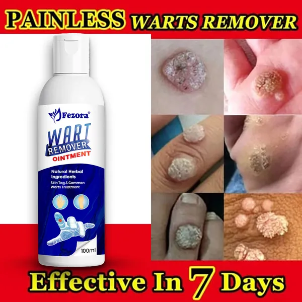 Jezora_Wart_Remover_Ointment
