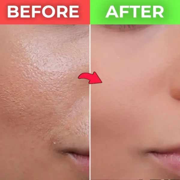 Meliq_10%_Niacinamide_Serum_with_Zinc_–_Reduces_Acne_Marks,_Controls_Oil_&_Minimizes_Pores_With_Gold_Scrub_Facewash_|_Vitamin_B3_for_Blemish-Free,_Clear_Skin