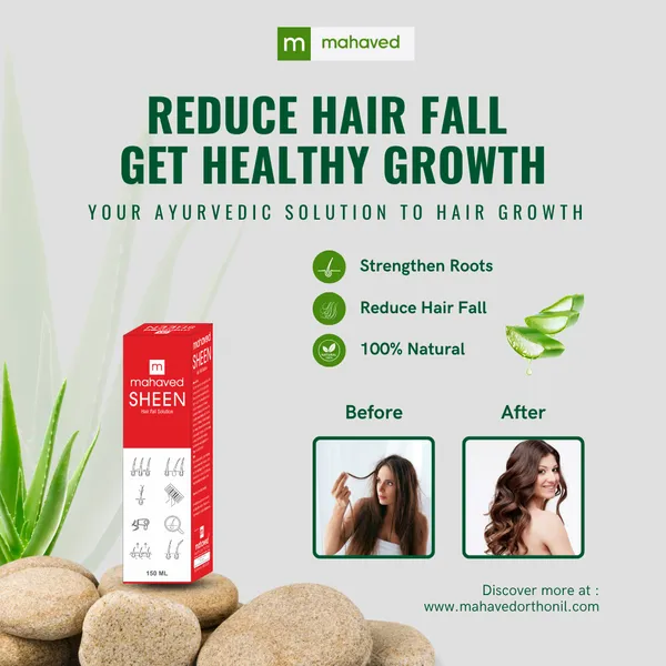 Sheen_Hair_Fall_Solution_150ml_Natural_Root_Activating_Helps_Control_Hair_Fall