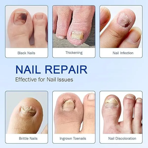 Brown_Adhesive_Hydrogel_Base_Infused_With_Active_Treatment_Polymers_Nail_Repair_Patches_For_Damaged,_Brittle,_Or_Discolored_Nails_Pack_Of_2