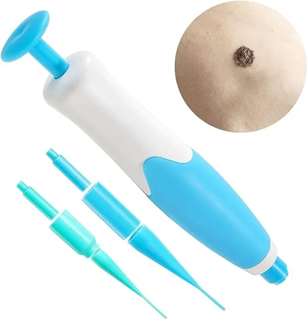 Blue_Medical-Grade_Abs_Plastic_Wand_And_Highly_Elastic_Silicone_Micro-Bands_Topical_Skin_Tag_Removal_Kit_For_Skin_Tag_Removal
