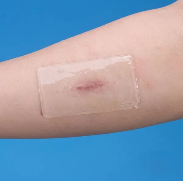 Scar_Adhesive_Gel_Sheet_For_Scars_10X10_Cm
