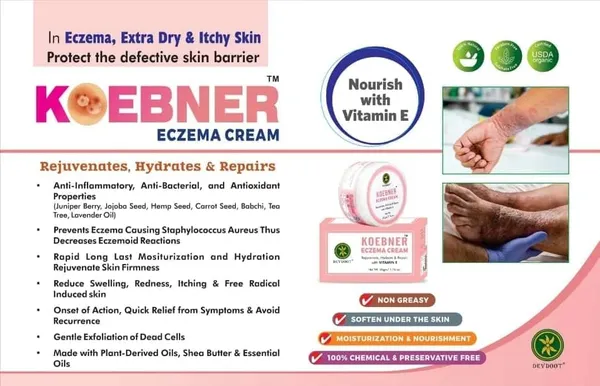 Koebner_Organic_Cream_for_ECZEMA_and_Extra_Dry_Skin,_100%_Natural,_Chemical_&_Preservative_Free,_Nourish_with_Vitamin_E_-_50gm