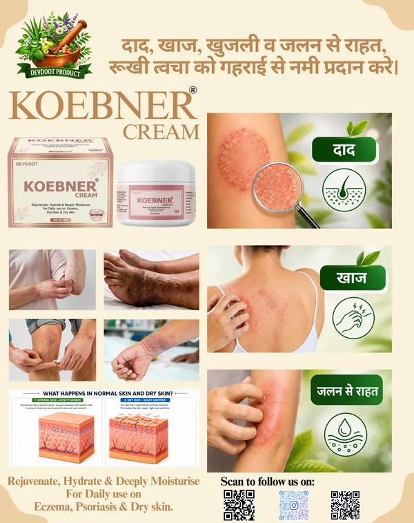 Koebner_Ayurvedic_Moisturizing_Cream_For_Eczema_And_Psoriasis_Deep_Hydration_Soothes_Itch_Redness_Non_Greasy_All_Season_Daily_Skincare_50_Gram_Pack_Of_2