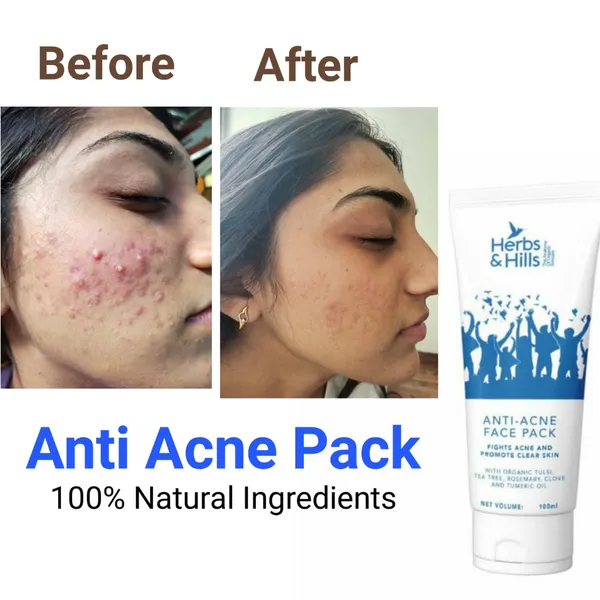 Pack_of_2_Herbs_Hills_Clarifying_Tea_Tree_Face_Wash_Anti_Ance_Facepack_Pimples_Combo_100_100_Ml_Anti_Acne_Organic_Natural_Help_To_Clear_Excess_Oil_Remove_Impurities_And_Prevent_Pimples_Relieving_Skin_Irritation