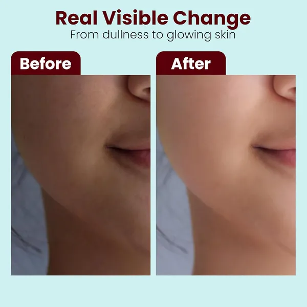 Rice_Water_Face_Serum_With_Niacinamide_And_Hyaluronic_Acid