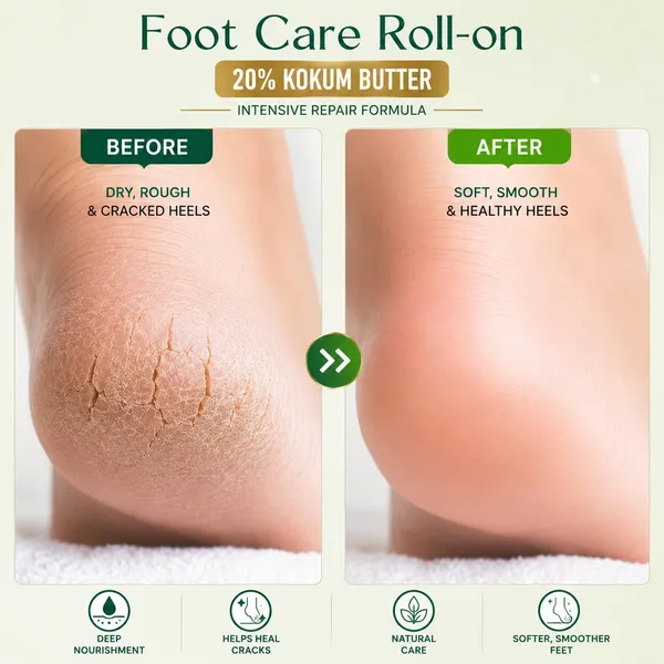Foot_Care_Roll_On_50ml_Crack_Heel_Repair_Cream_Foot_Cream_For_Dry_Cracked_Feet_&_Foot_Relief_Roll_On_50_Ml_For_Burning_Sore_Feet_Relief_Cooling_Foot_Care_(Combo_of_2)