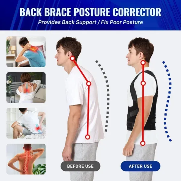 IntelliFit_Posture_Corrector_Belt_Pro_for_Men_And_Women_Back_Support_Belt_for_Straight_Back_Back_/_Lumbar_Support_(Black)