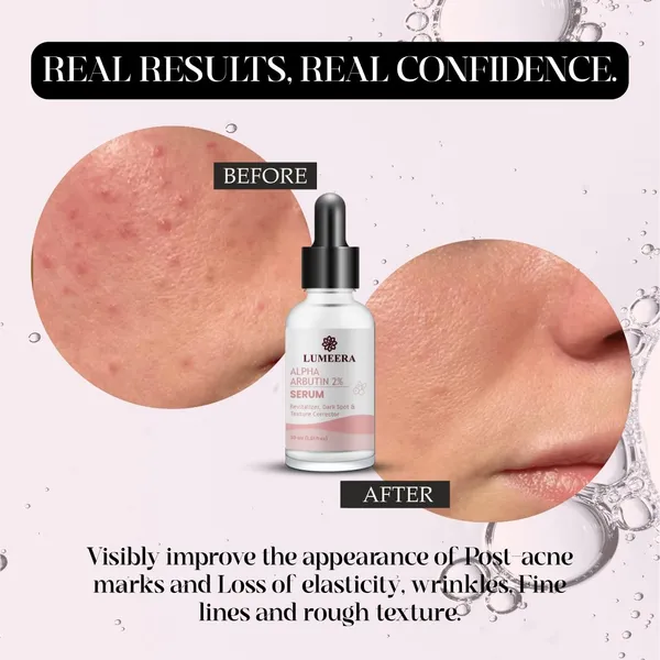 Alpha_Arbutin_2_Serum_Dark_Spot_And_Texture_Corrector_Glass_Bottle_Unscented_All_Skin_Types_Face_Treatment_20Ml