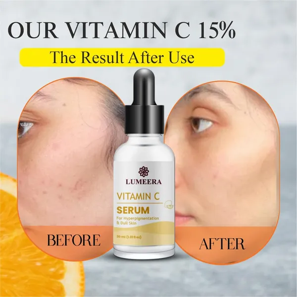 Vitamin_C_&_Ferulic_Acid_Serum_Hyperpigmentation_Dull_Skin_30Ml