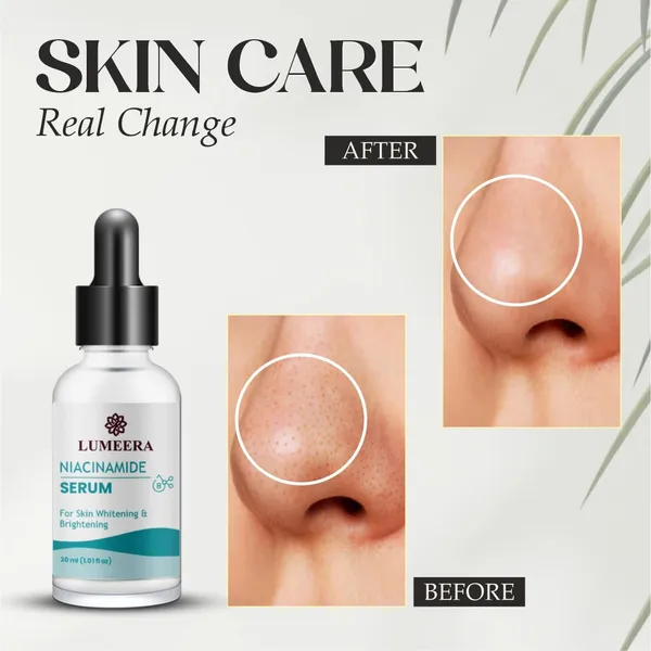 Niacinamide_Serum_For_Skin_Whitening_And_Brightening_Glass_Bottle_Unscented_All_Skin_Types_Face_Treatment_30Ml
