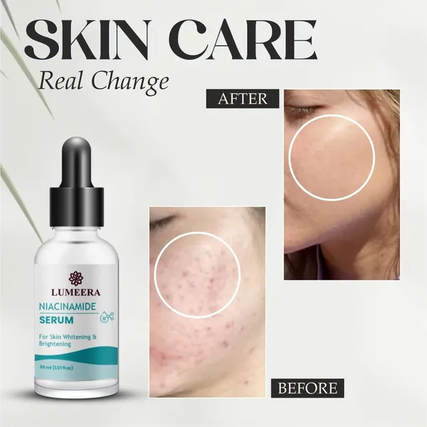 Niacinamide_Serum_For_Skin_Whitening_And_Brightening_Glass_Bottle_Unscented_All_Skin_Types_Face_Treatment_30Ml