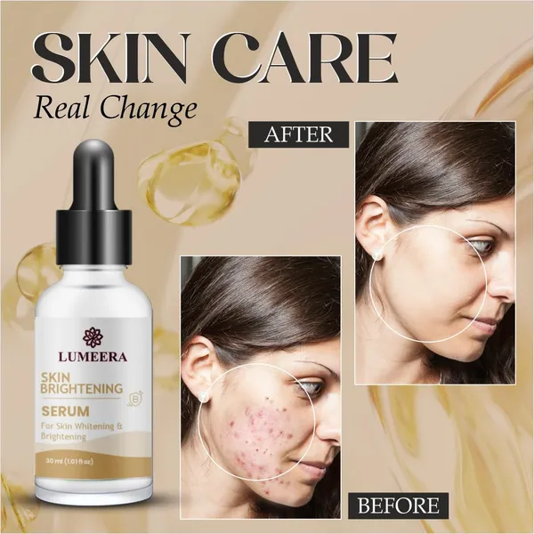 Skin_Brightening_Serum_Natural_Whitening_Treatment_With_Dropper_30Ml_Advanced_Facial_Care_Formula
