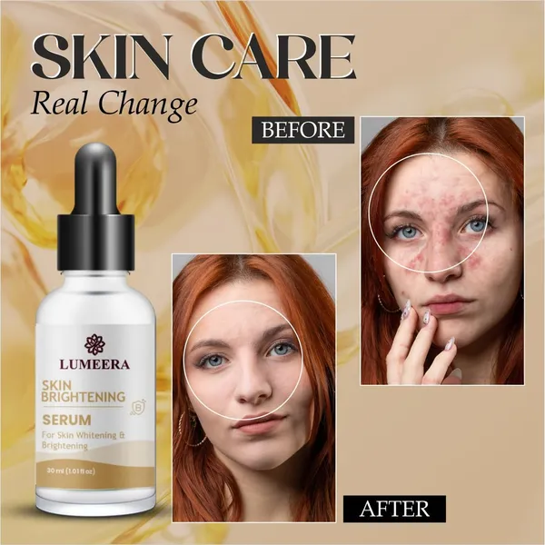 Skin_Brightening_Serum_Natural_Whitening_Treatment_With_Dropper_30Ml_Advanced_Facial_Care_Formula