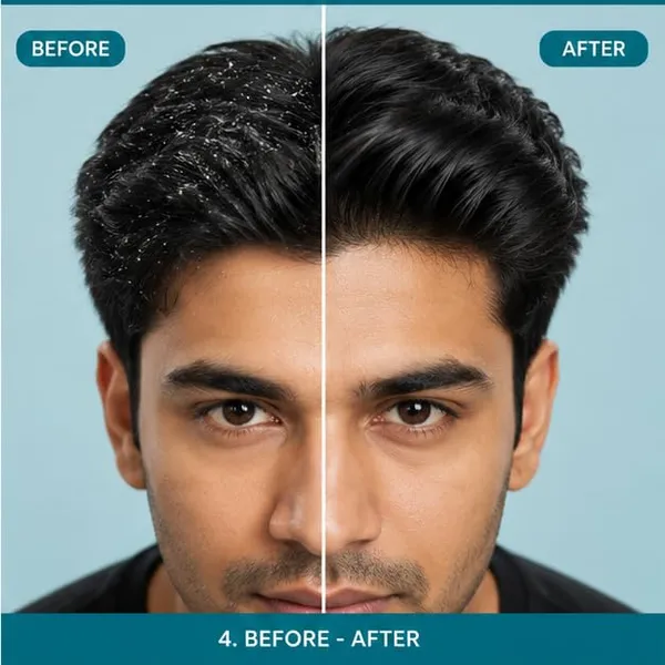 Anti_Dandruff_Conditioner_200Ml_Scalp_Care_Hair_Conditioner_For_Smooth_Manageable_Hair_Suitable_For_Men_And_Women