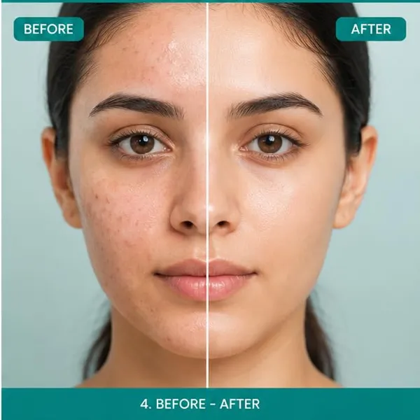1_Percent_Salicylic_Acid_Facewash_100Ml_Daily_Facial_Cleanser_For_Oily_Skin_And_Pore_Cleansing_Face_Wash_For_All_Skin_Types