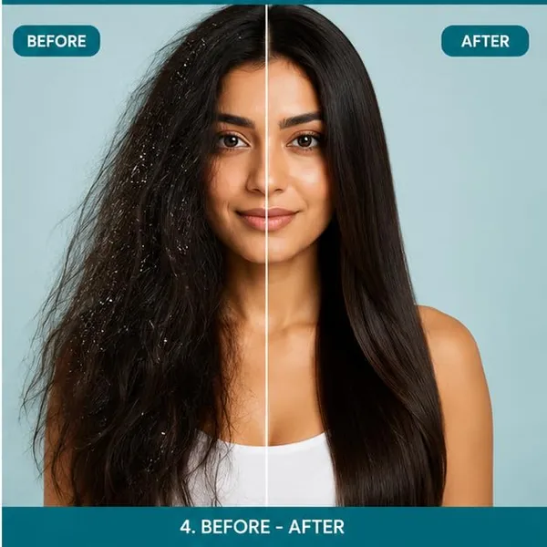 Shampoo_Collection_Rosemary_Rice_Water_Anti_Dandruff_7_In_1_Repair_All_Hair_Types_200Ml_Anti_Dandruff_Shampoo