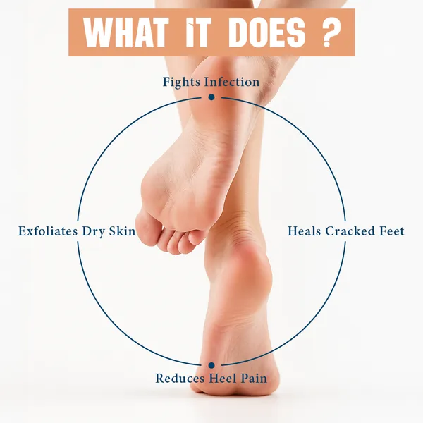 Anti_Crack_Foot_Cream