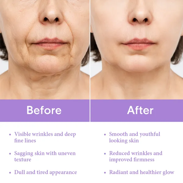 Retinol_Super_Serum