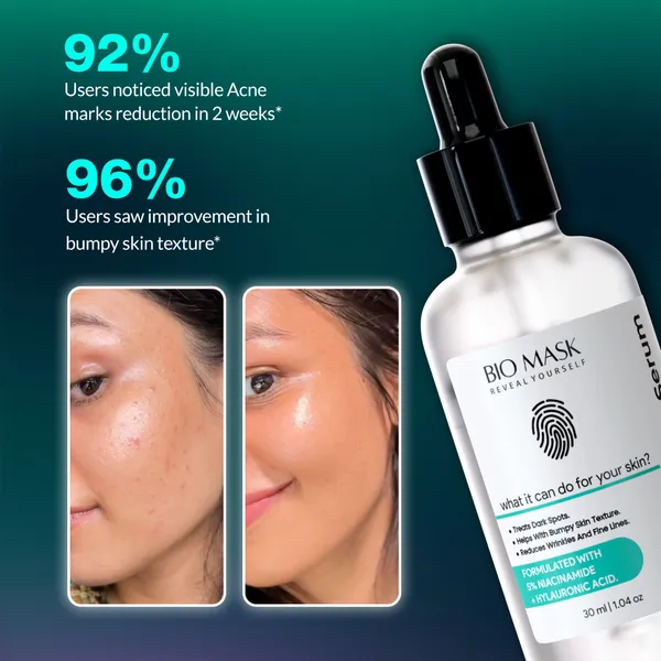 Oil_Control_Serum_5_Niacinamide_Hyaluronic_Acid_Serum_30_Ml