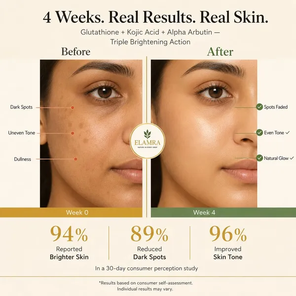 ELAMRA_Glutathione_Moisturizer_with_Niacinamide,_Kojic_Acid_&_Alpha_Arbutin_|_Even_Skin_Tone,_Antioxidant_Care_&_Deep_Hydration_|_For_All_Skin_Types_|_50g