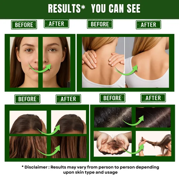 Tea_Tree_Essential_Oil_For_Skin_Hair_And_Aromatherapy