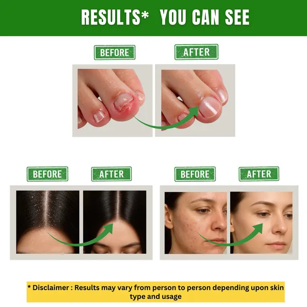Multifunctional_Essential_Oil_For_Skin_Hair_And_Aromatherapy