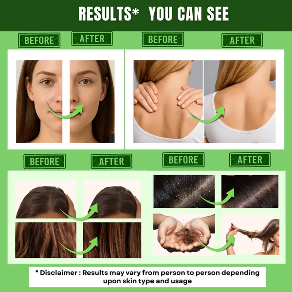 Krisspaa_Organics_100%_Pure_Natural_Therapeutic_Grade_Rosemary_Essential_Oil