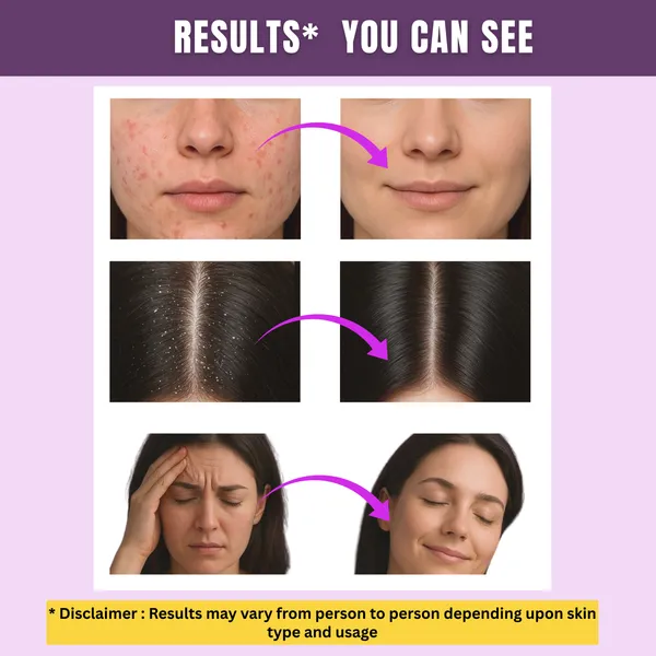 Lavender-Essential-Oil
