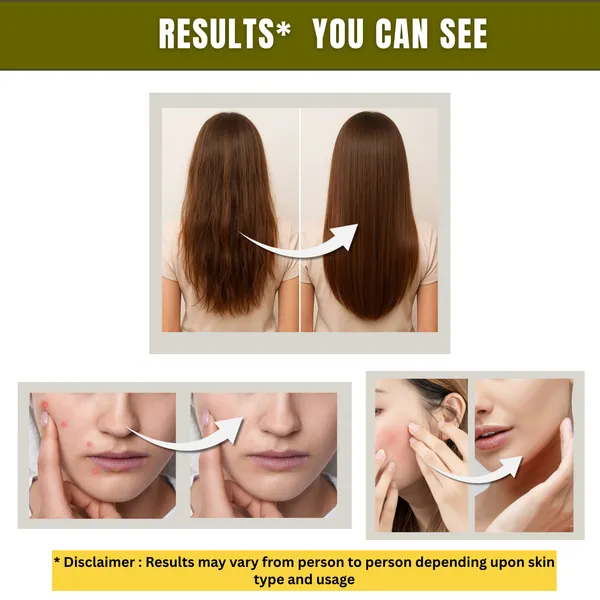 Multipurpose_Essential_Oil_For_Skin_Hair_And_Aromatherapy