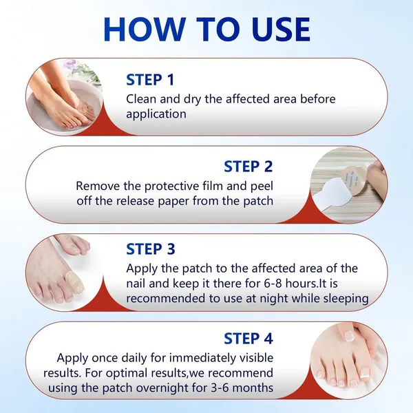 Fungal_Nail_Patch_Treatment_�_Powerful_Antifungal_Solution_|_Targets_Nail_Fungus_at_the_Root_|_Easy-to-Use_Patch_for_Toenail_&_Fingernail_|_21_Patches