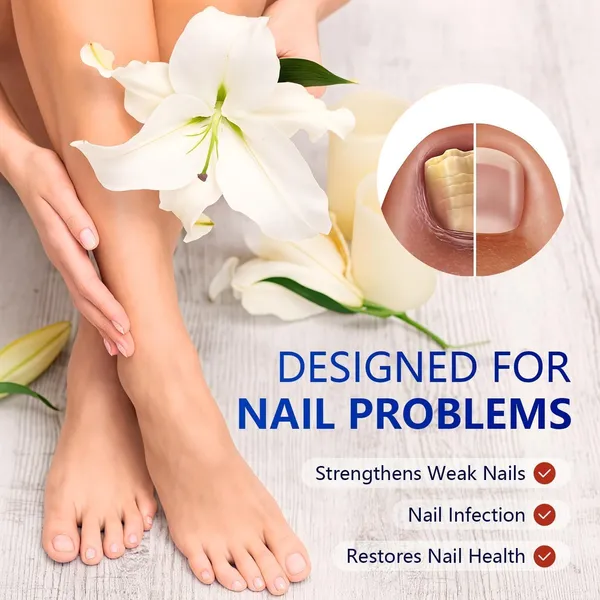 Fungal_Nail_Patch_Treatment_�_Powerful_Antifungal_Solution_|_Targets_Nail_Fungus_at_the_Root_|_Easy-to-Use_Patch_for_Toenail_&_Fingernail_|_21_Patches
