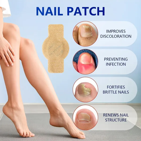 Fungal_Nail_Patch_Treatment_�_Powerful_Antifungal_Solution_|_Targets_Nail_Fungus_at_the_Root_|_Easy-to-Use_Patch_for_Toenail_&_Fingernail_|_21_Patches