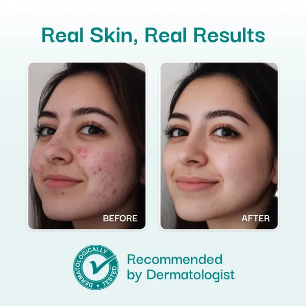 Vissence_Fresh_Detox_Face_Wash