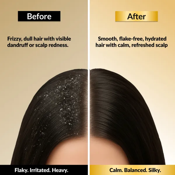 EleGanz_Professional_ScalpMatrix™_Anti-Dandruff_Shampoo_|_Salicylic_Acid,_Dandrilys_&_Climbazole_for_Flakes_&_Itchy_Scalp
